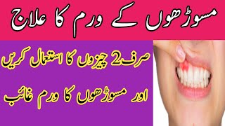 masoro me waram ka ilaj in urduGums Swelling Treatment [upl. by Abas674]