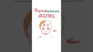 Propionibacterium acnes  Acne Vulgaris  Microbiology science microbiology nurse doctor mbbs [upl. by Eigram]