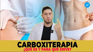 CARBOXITERAPIA flacidez celulitis y estrías  DOCTOR LEMUS [upl. by Tol]