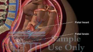 Umbilical Cord Compression  Maternal Fetal Circulation Medical 3D Animation [upl. by Kumagai584]