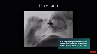 Philips Cineloop and Autograb fluoroscopy solutions animation video [upl. by Maleen]