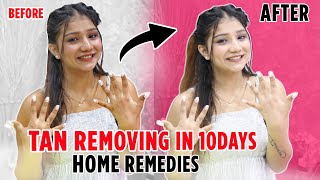 Remove Tan at HOME In Just 1 WEEK 😱  HOME REMEDY [upl. by Vincenta]